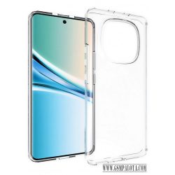 Xiaomi Redmi Note 15 5G vékony szilikon hátlap,Átlátszó